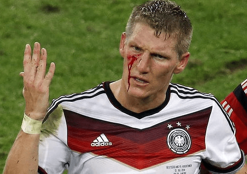 This is what he looked like just before Germany won the World Cup.